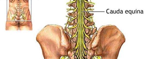 Banner Image for Sciatica Pain Relief Using Massage Therapy. Is Massage Therapy Alternative Medicine?